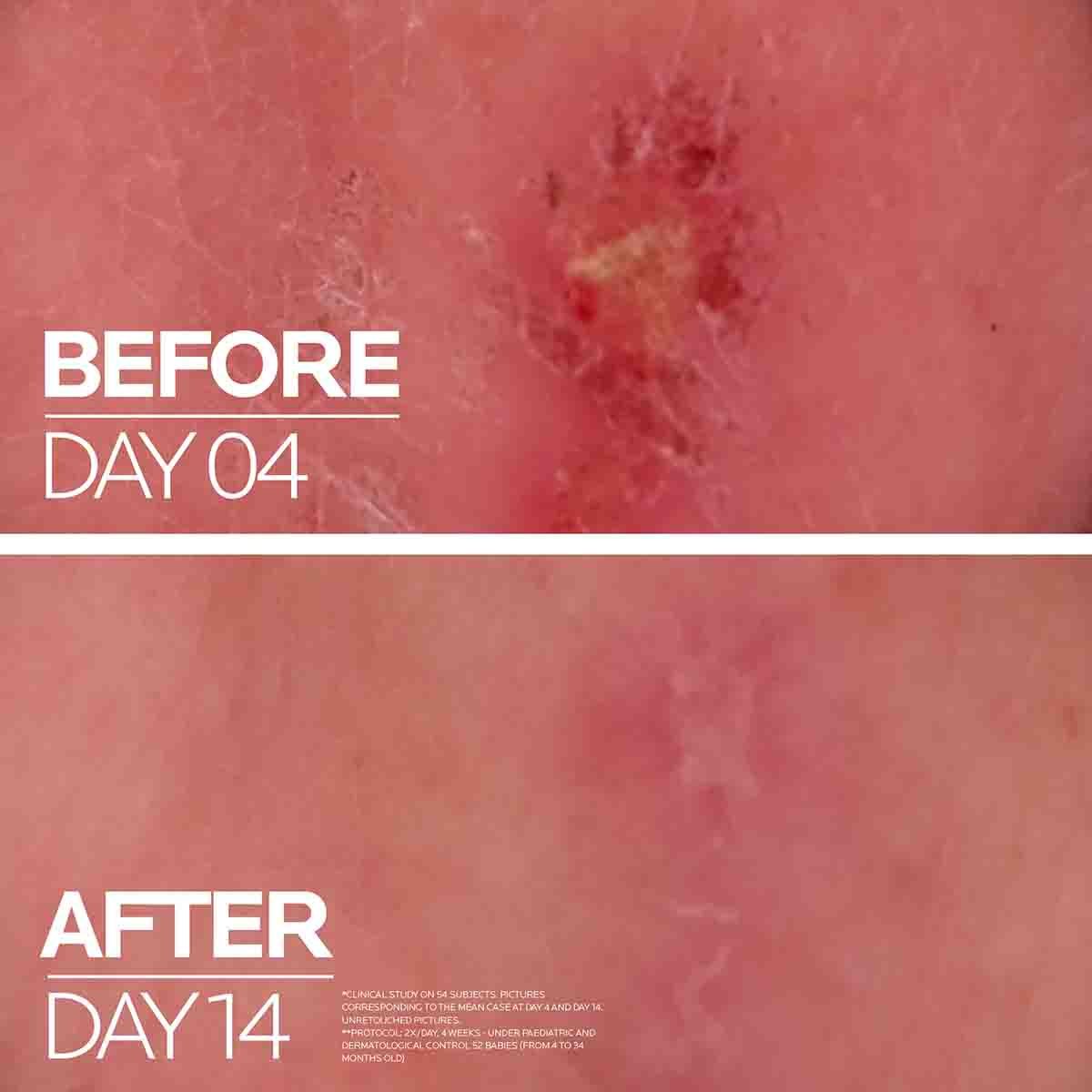 Cicaplast Baume B5+ Ultra-Repairing Soothing Balm - image 12