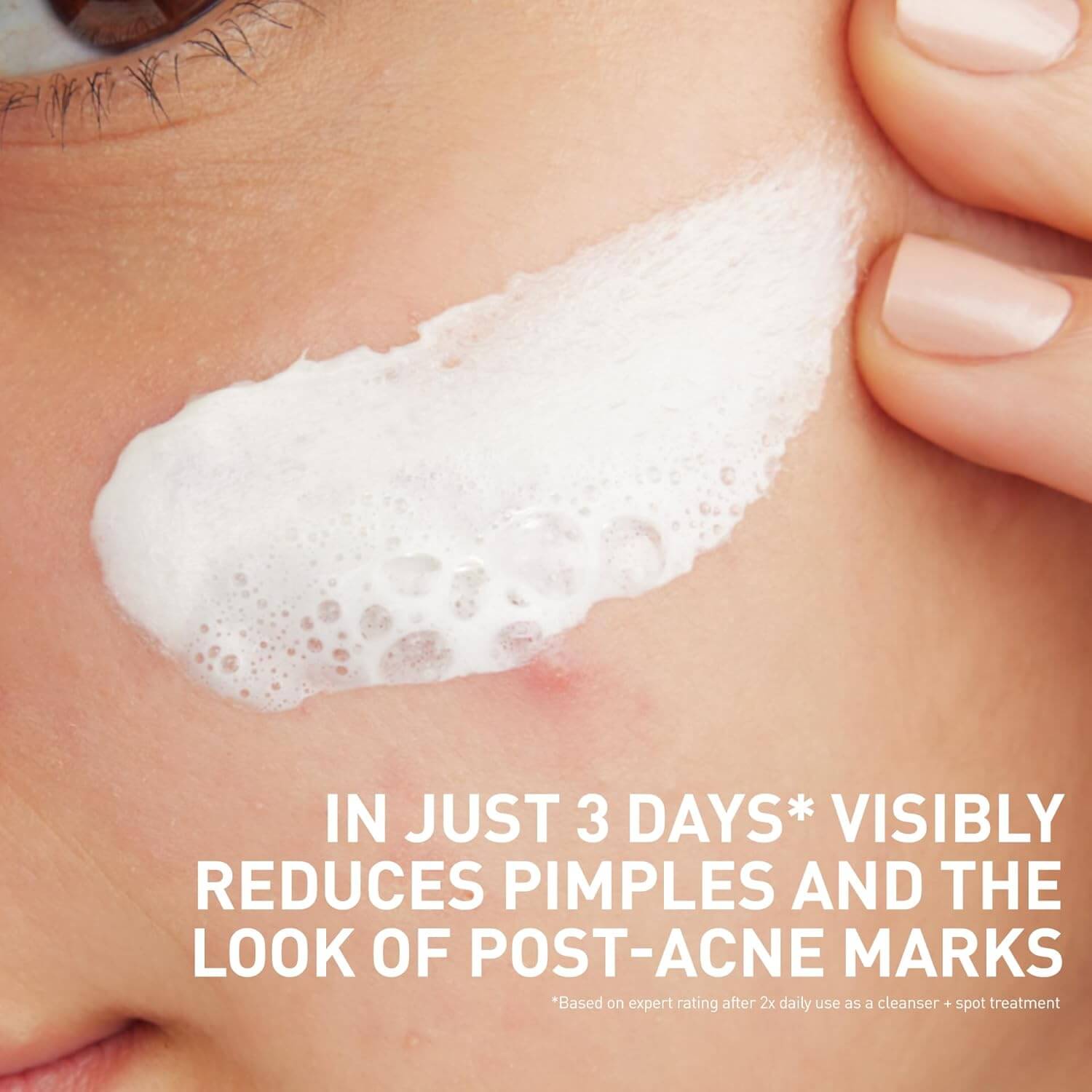Acne Clay To Foam Cleanser - image 5