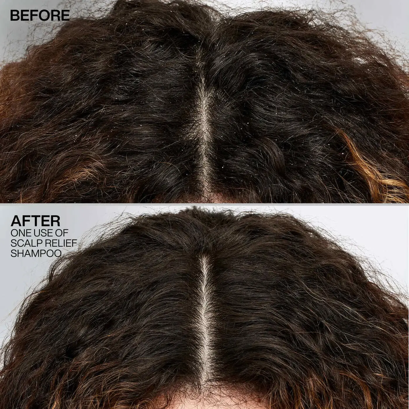 Scalp Relief Dandruff Control Shampoo - image 6