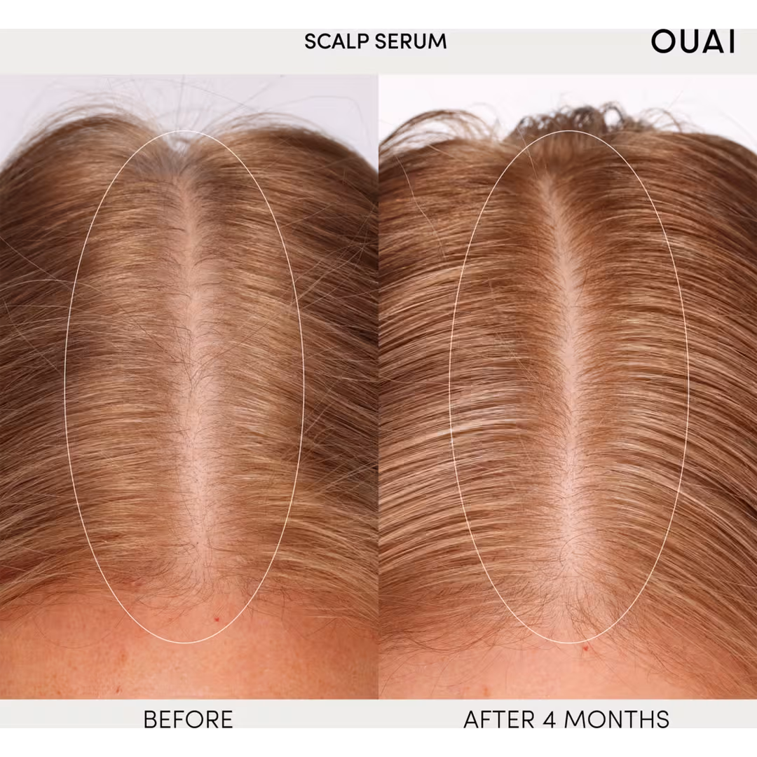Scalp Serum - image 7