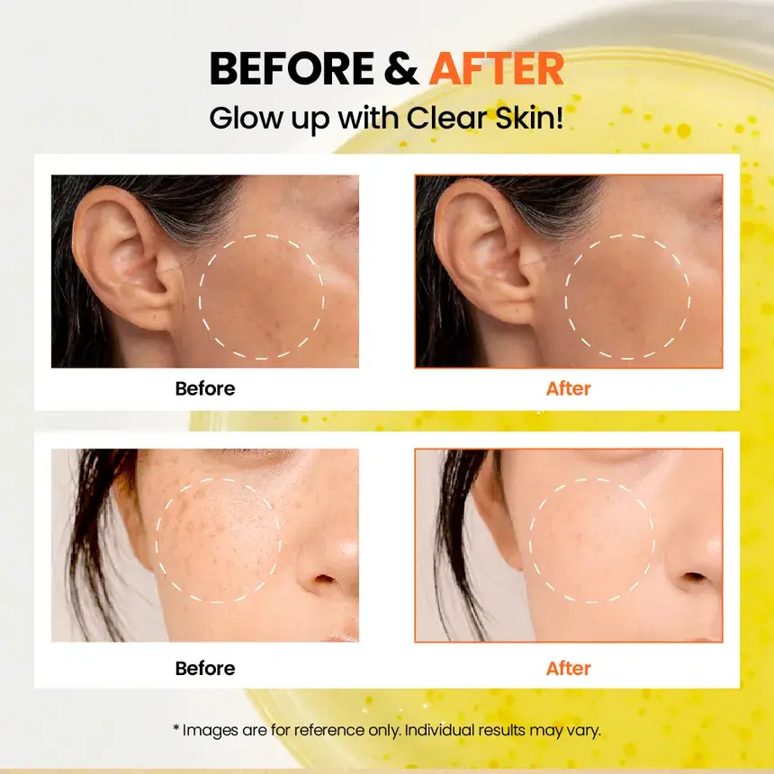 Seoul 1988 Glow Serum : Niacinamide 15% + Yuja - image 7