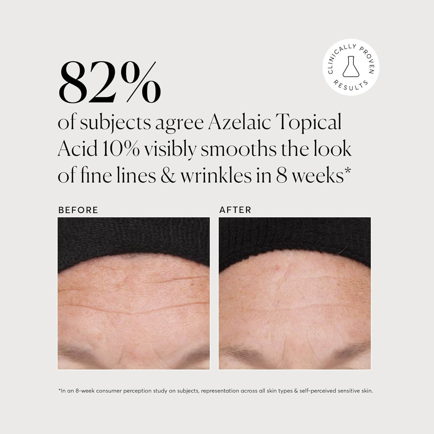 Azelaic Topical Acid 10% - image 8