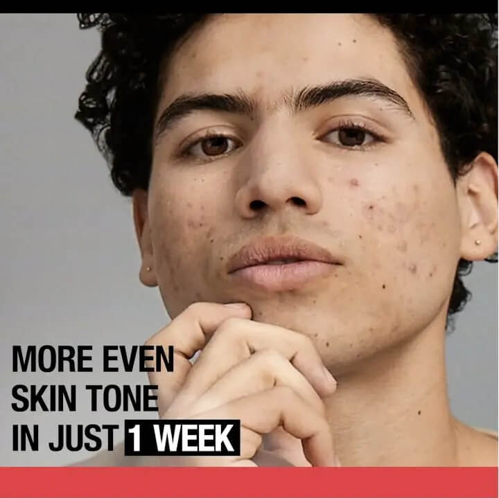 Stubborn Marks PM Treatment - image 3