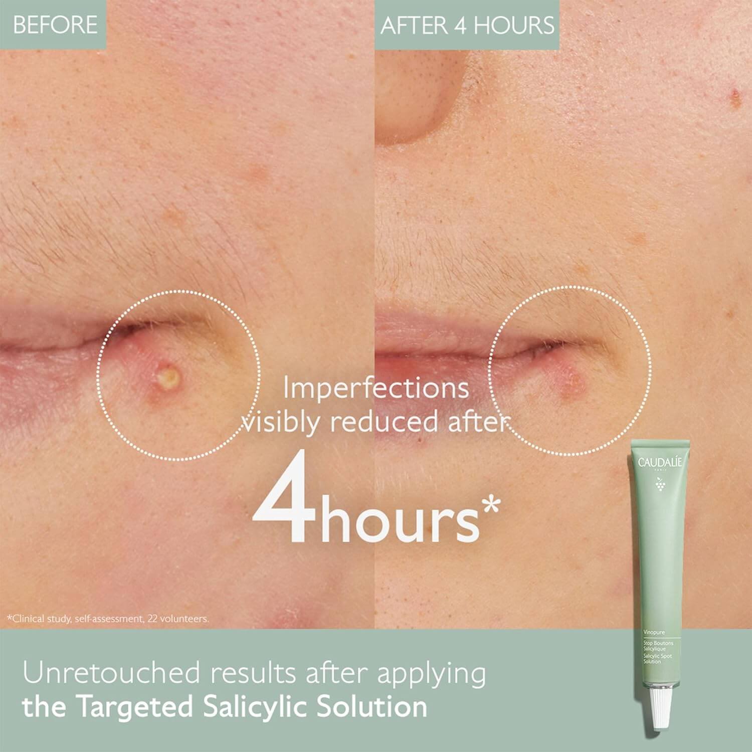 Vinopure Salicylic Spot Solution - image 4