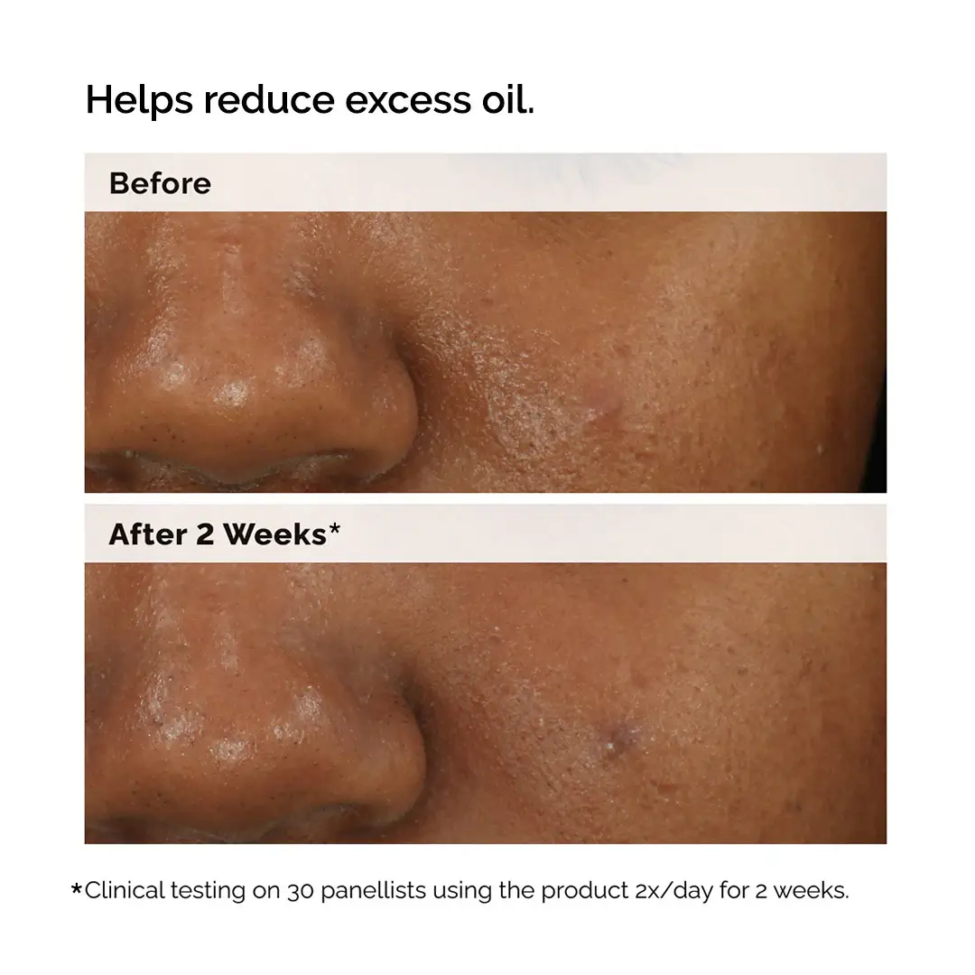 Balancing & Clarifying Serum - image 10