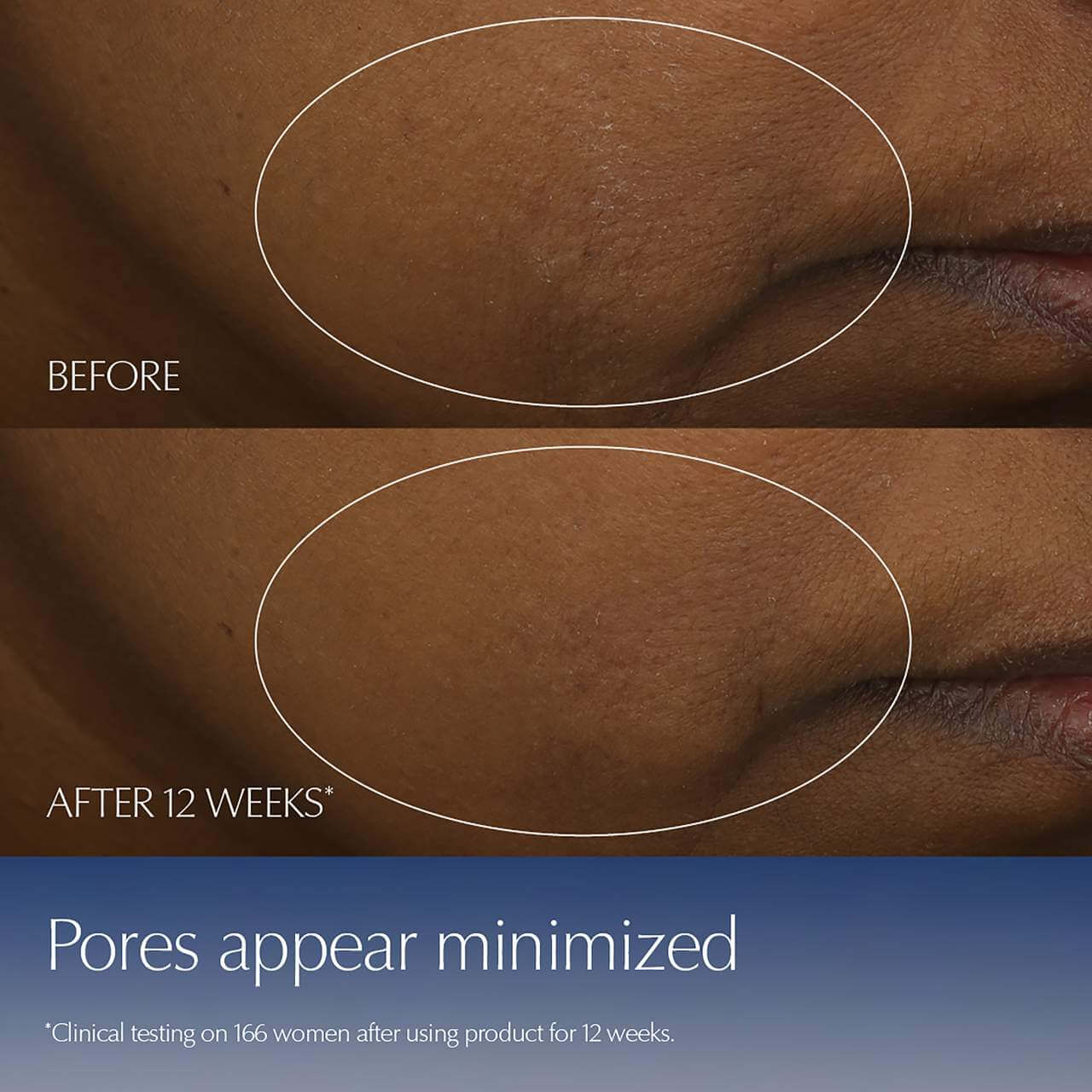 Advanced Night Repair Serum  - image 6