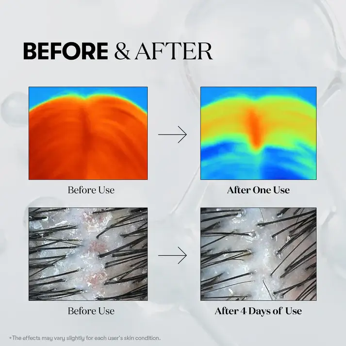 PDRN Reedle Shot Hair Ampoule 300dL - image 7