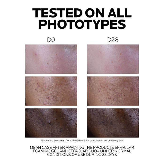 Effaclar Duo + M Anti Imperfections Moisturiser - image 7