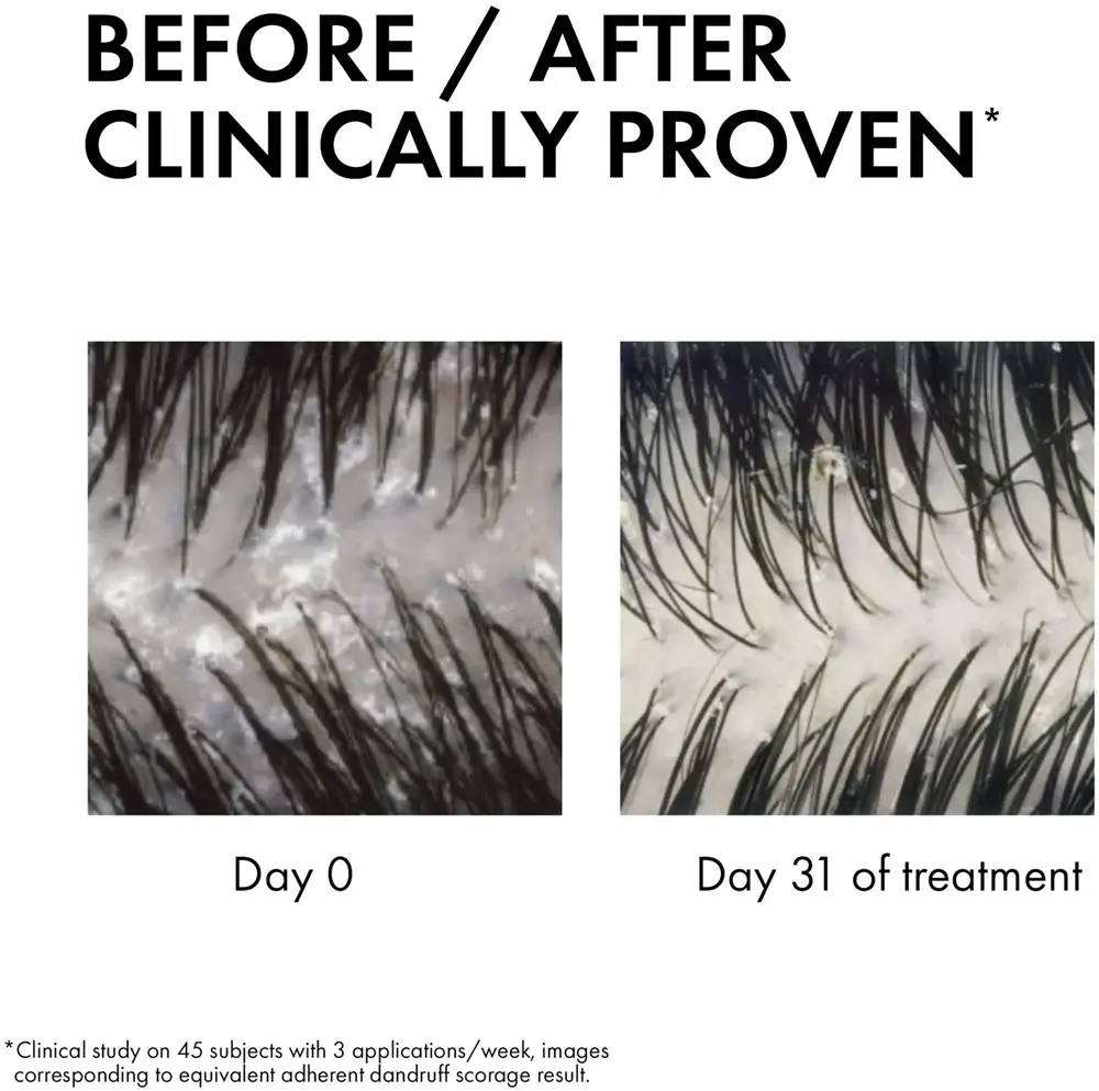 Dercos 2-In-1 Anti-Dandruff Shampoo - image 5