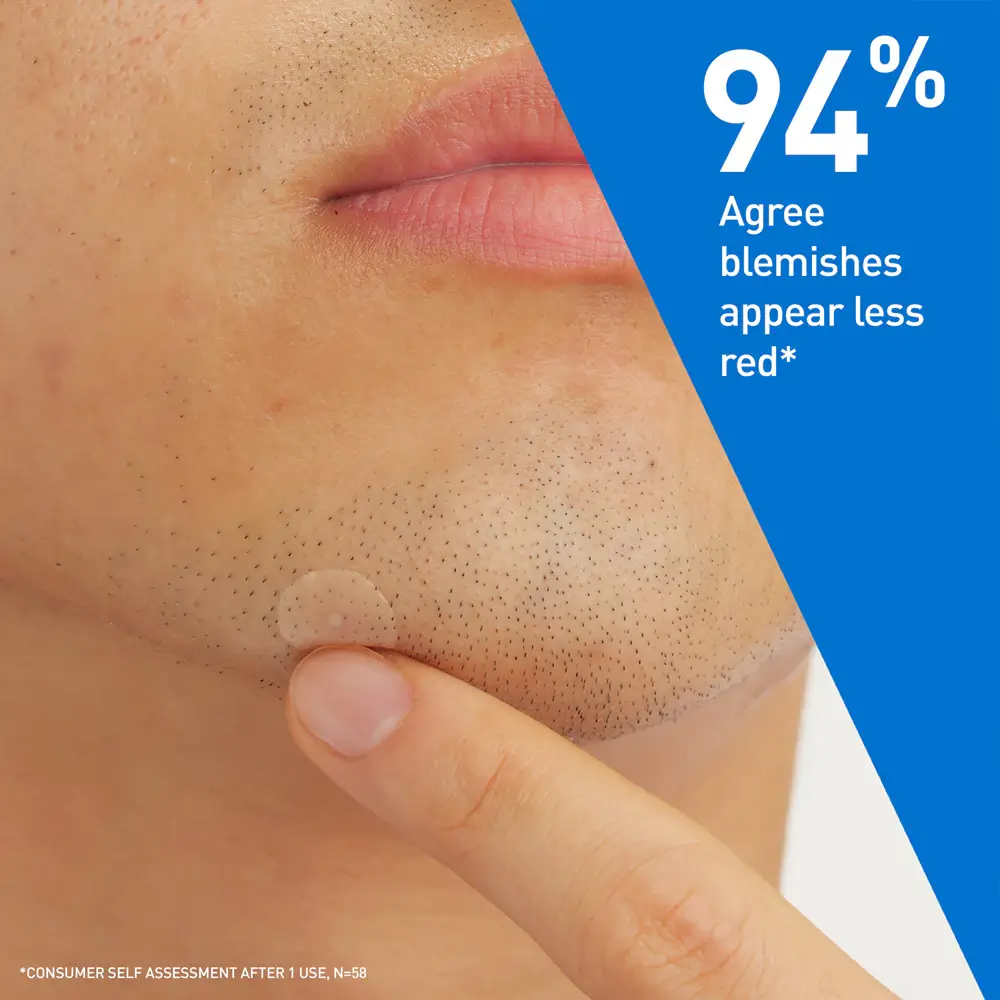 Blemish Barrier Patches - image 8