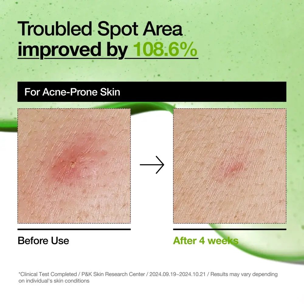  Azelaic Acid 10 Hyaluron Redness Soothing Serum - image 3