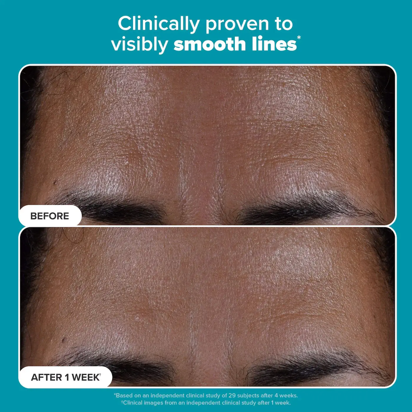 Skin Perfecting 2% BHA Liquid Exfoliant - image 7