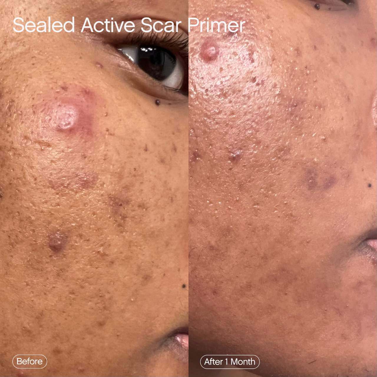 Sealed Active Scar Primer - image 8