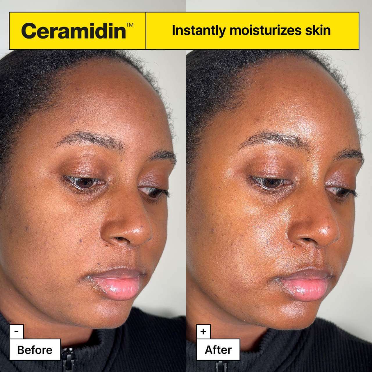 Ceramidin™ Skin Barrier Moisturising Cream - image 3