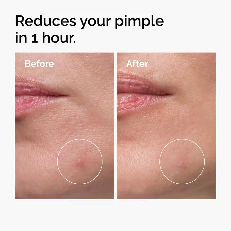 Sulfur 10% Powder-to-Cream Concentrate - image 4