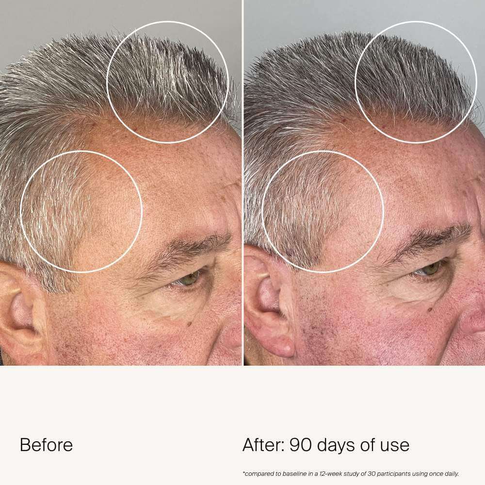 Scalp Care Density Serum - image 8