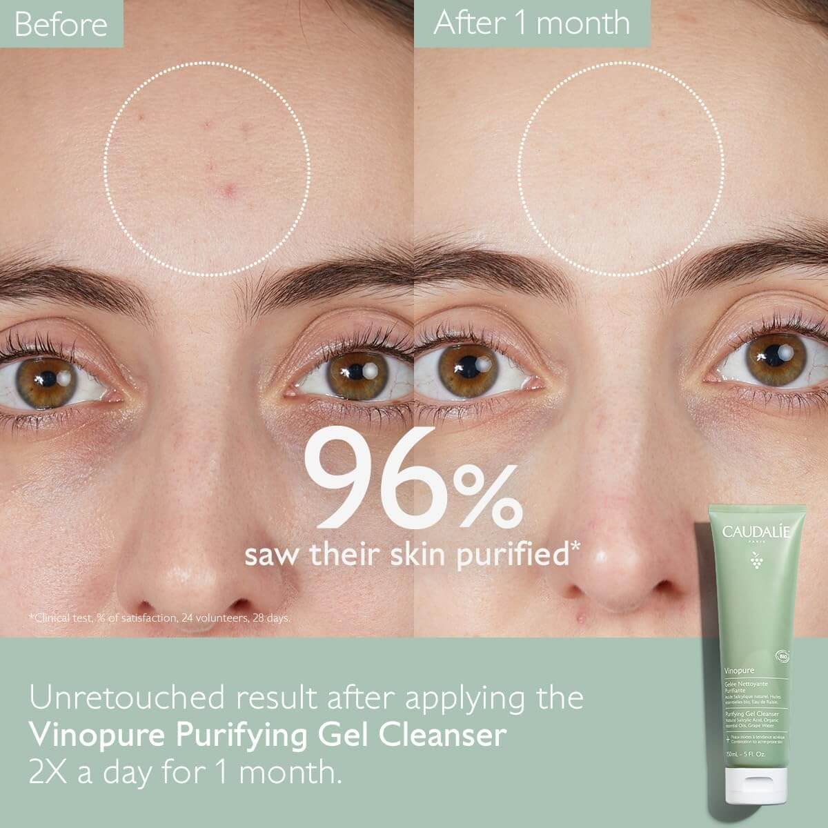 Vinopure Purifying Gel Cleanser - image 4
