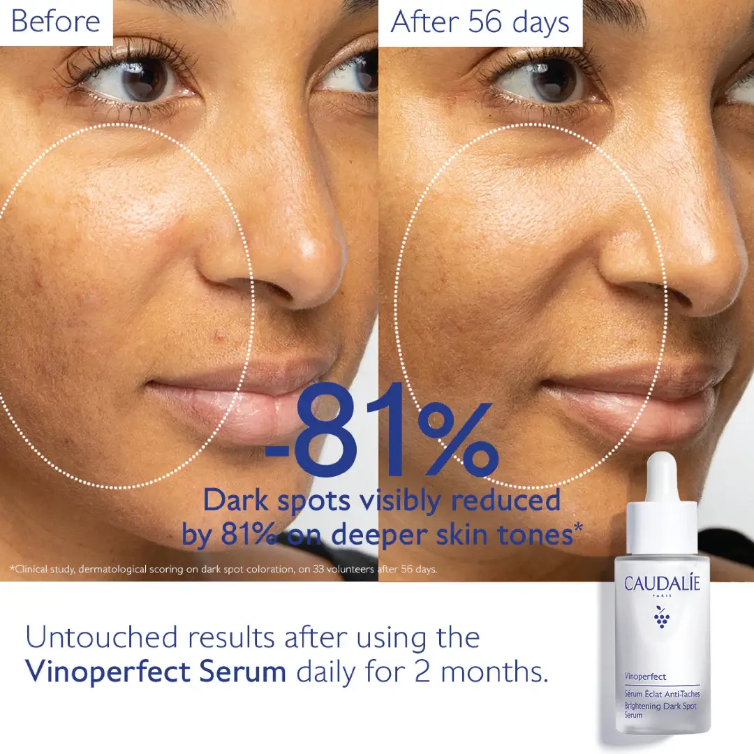  Vinoperfect Dark Spot Brightening Serum & Sunscreen SPF 50 Set - image 6