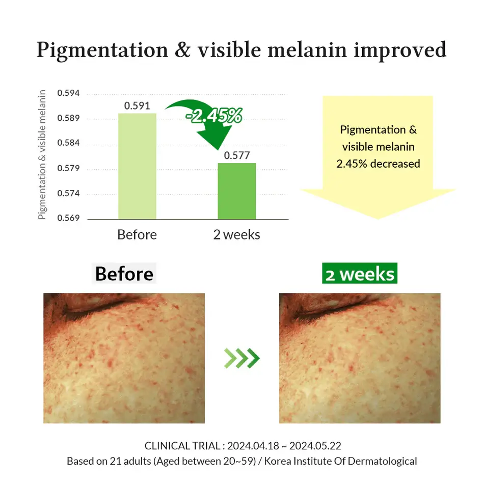 Gentle Vitamin C Serum - image 6