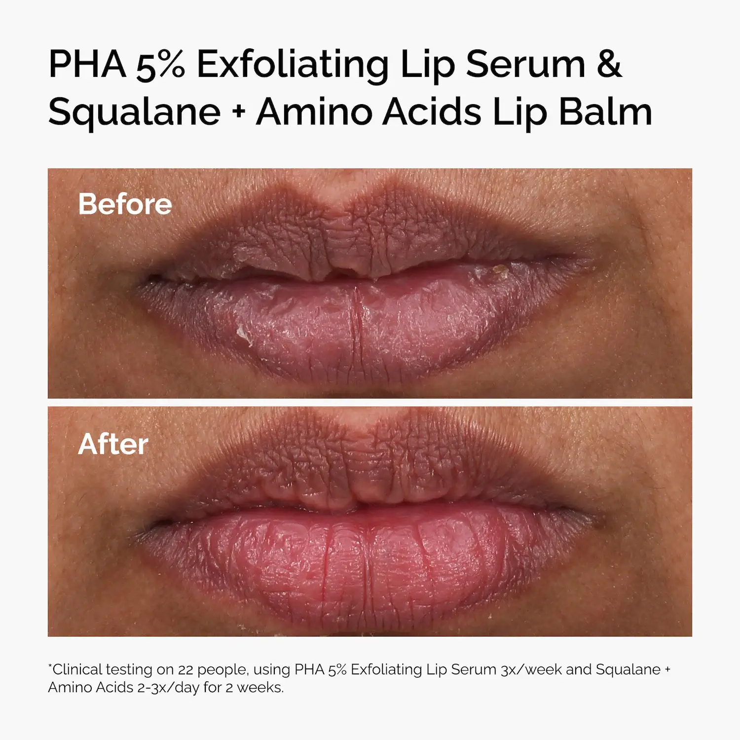 PHA 5% Exfoliating Lip Serum - image 7