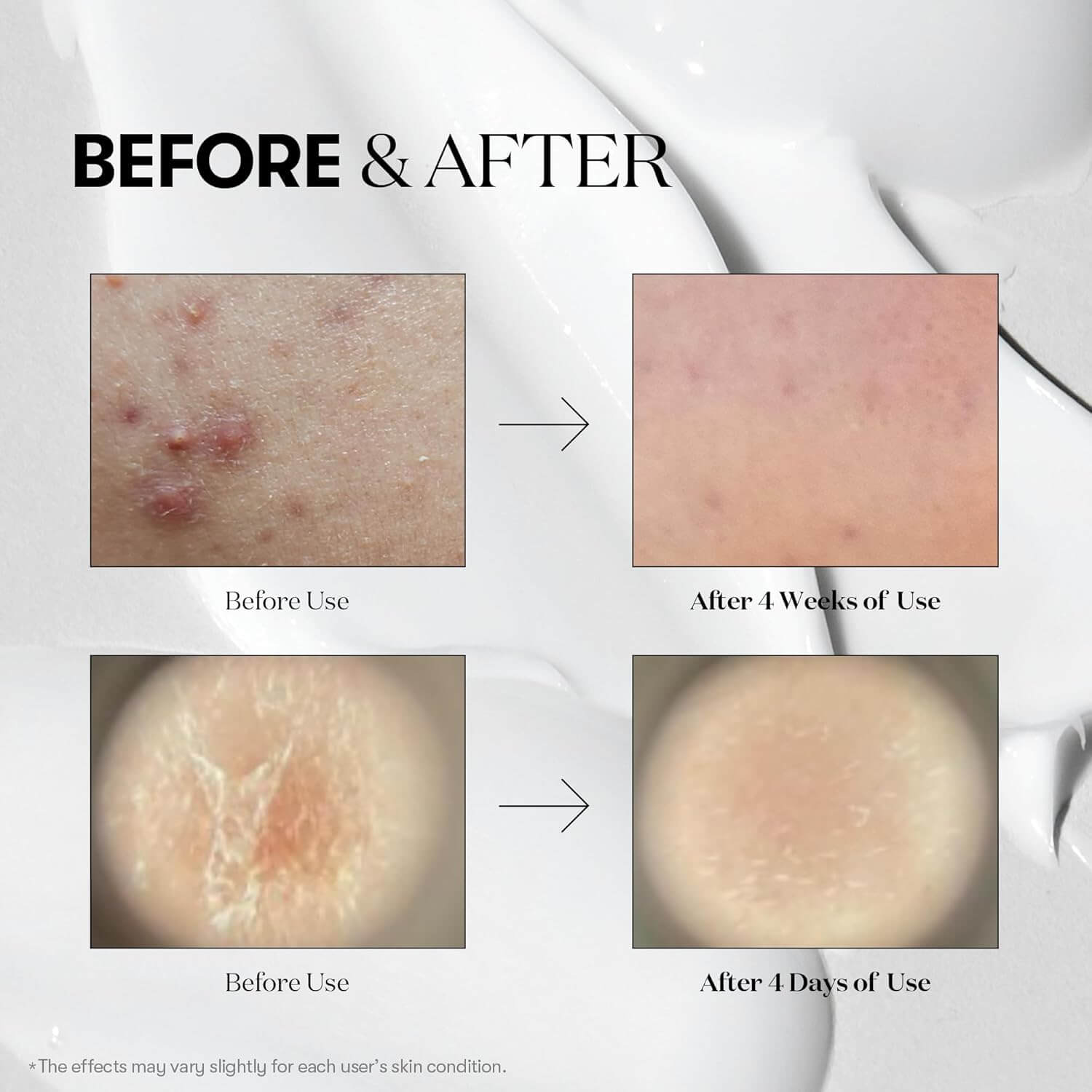 Reedle Shot 100 - image 6