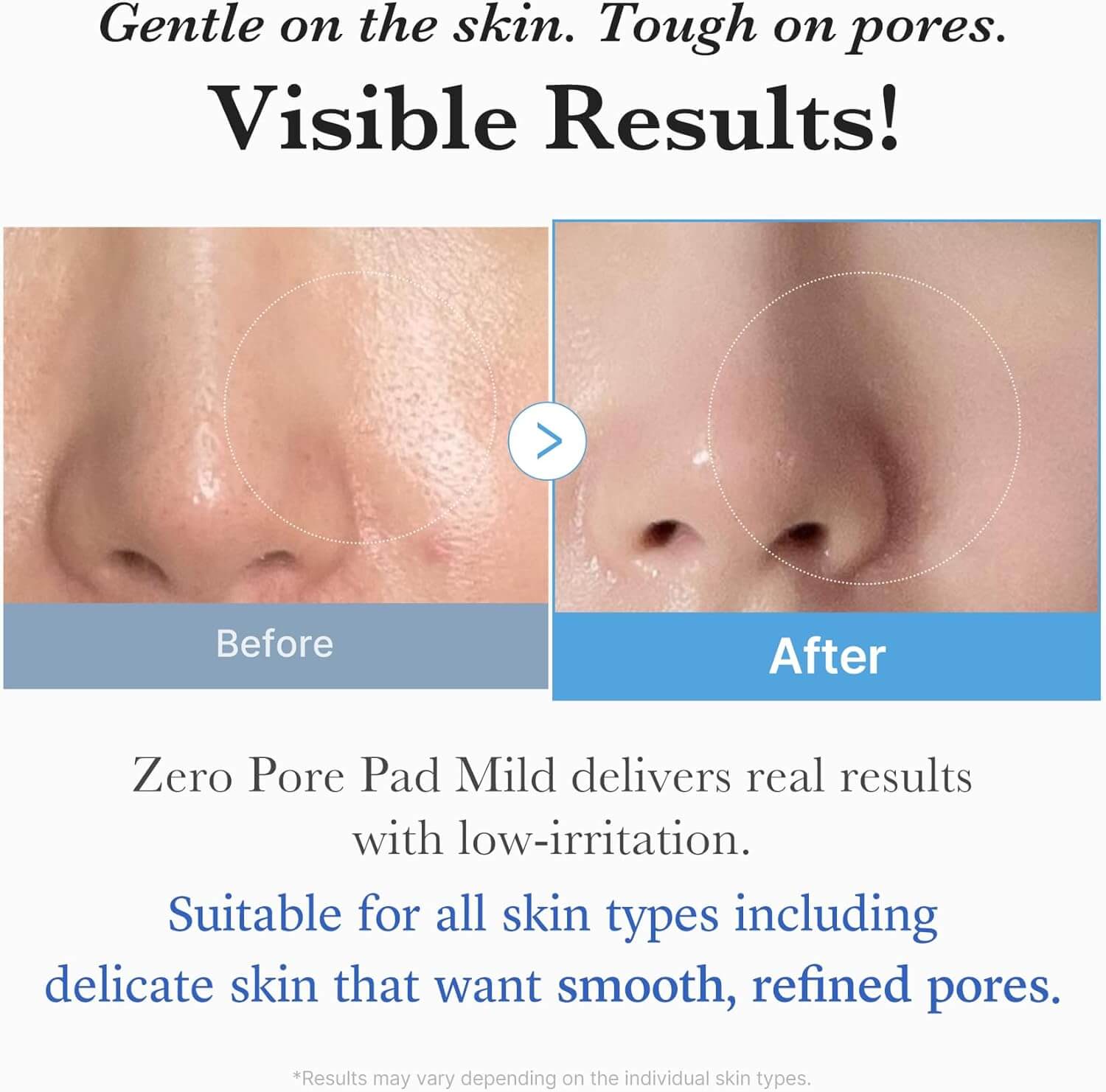 Zero Pore Pad Mild - image 6